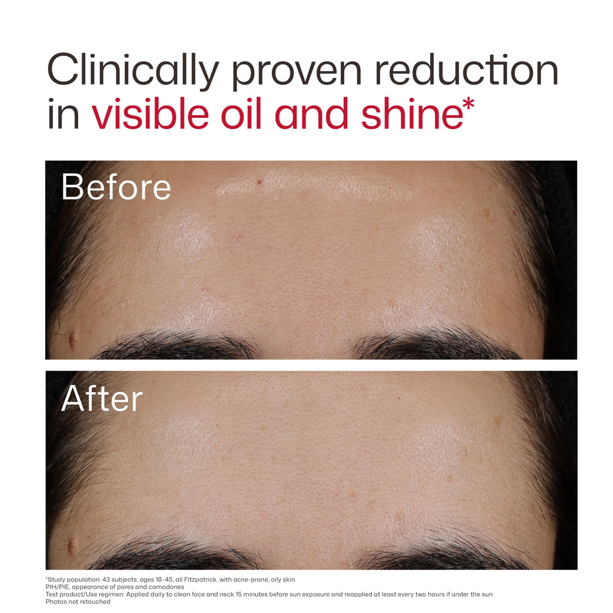 Eltamd UV Clear Face Sunscreen Spf, Oil-Free Sunscreen with Zinc Oxide, Dermatologist Recommended