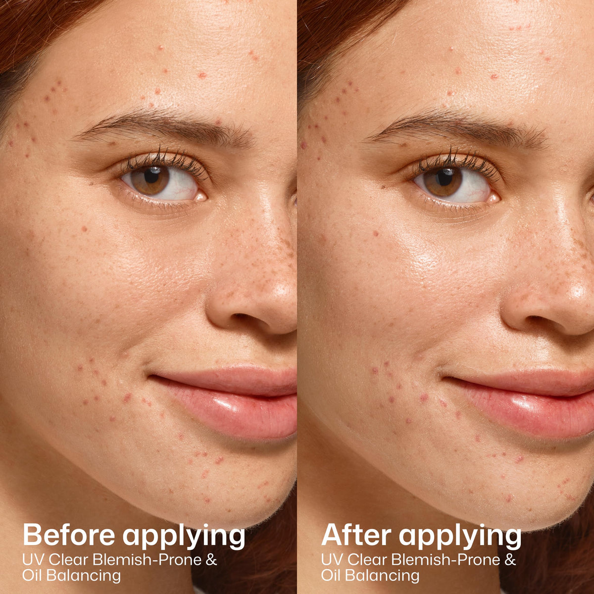 Eltamd UV Clear Face Sunscreen Spf, Oil-Free Sunscreen with Zinc Oxide, Dermatologist Recommended