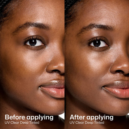 Eltamd UV Clear Face Sunscreen Spf, Oil-Free Sunscreen with Zinc Oxide, Dermatologist Recommended