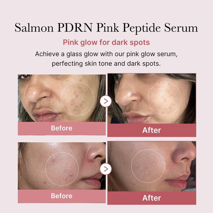 Pdrn Pink Peptide Brightening Glow Serum 30ml - Collagen Hydrating & Firming Essence for Radiant Skin | Moisturizing Anti Dullness Facial Serum